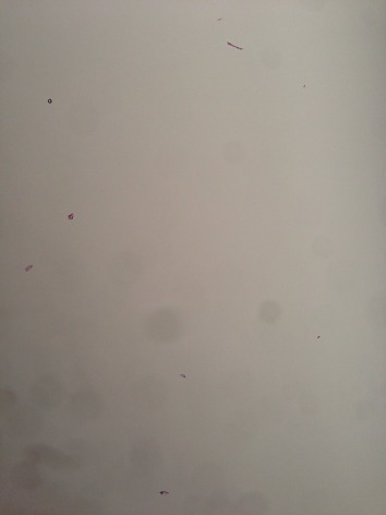 IPhone 5 camera has dust on lens and purple marks on camera - 1